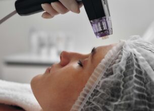 radiofrekwencja mikroigłowa